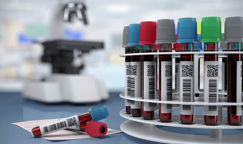 France : la pression eugénique s’intensifie