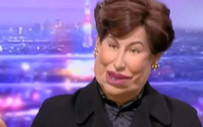 Bachelot