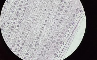 Chromosomes2